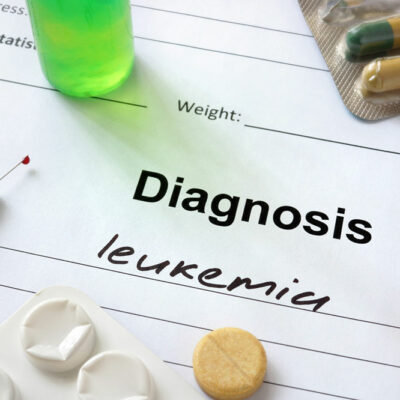 Acute Myeloid Leukemia – Stages, Types, Symptoms, Causes, and Therapies
