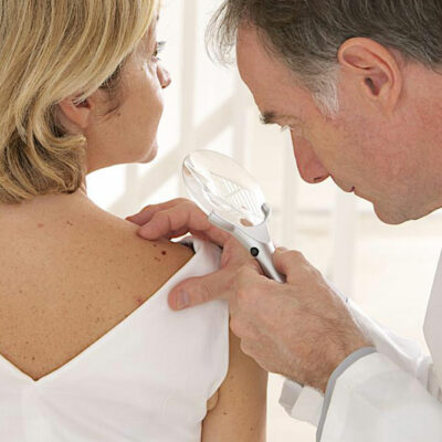 Metastatic malignant melanoma – types of treatment