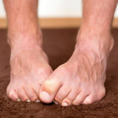 Neuropathy Foot Pain – Symptoms, Causes, Treatments and More