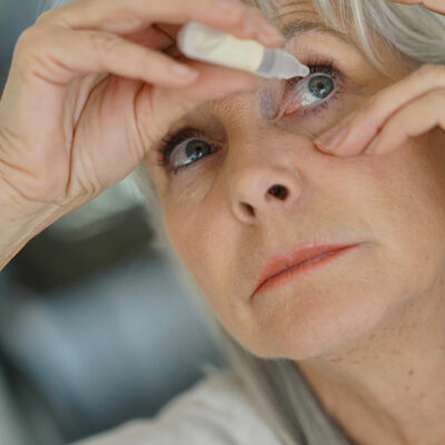 Dry eyes – Symptoms, causes, and treatment